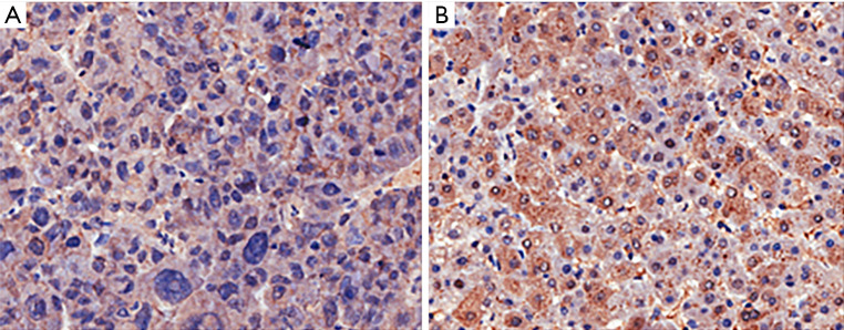 IHC